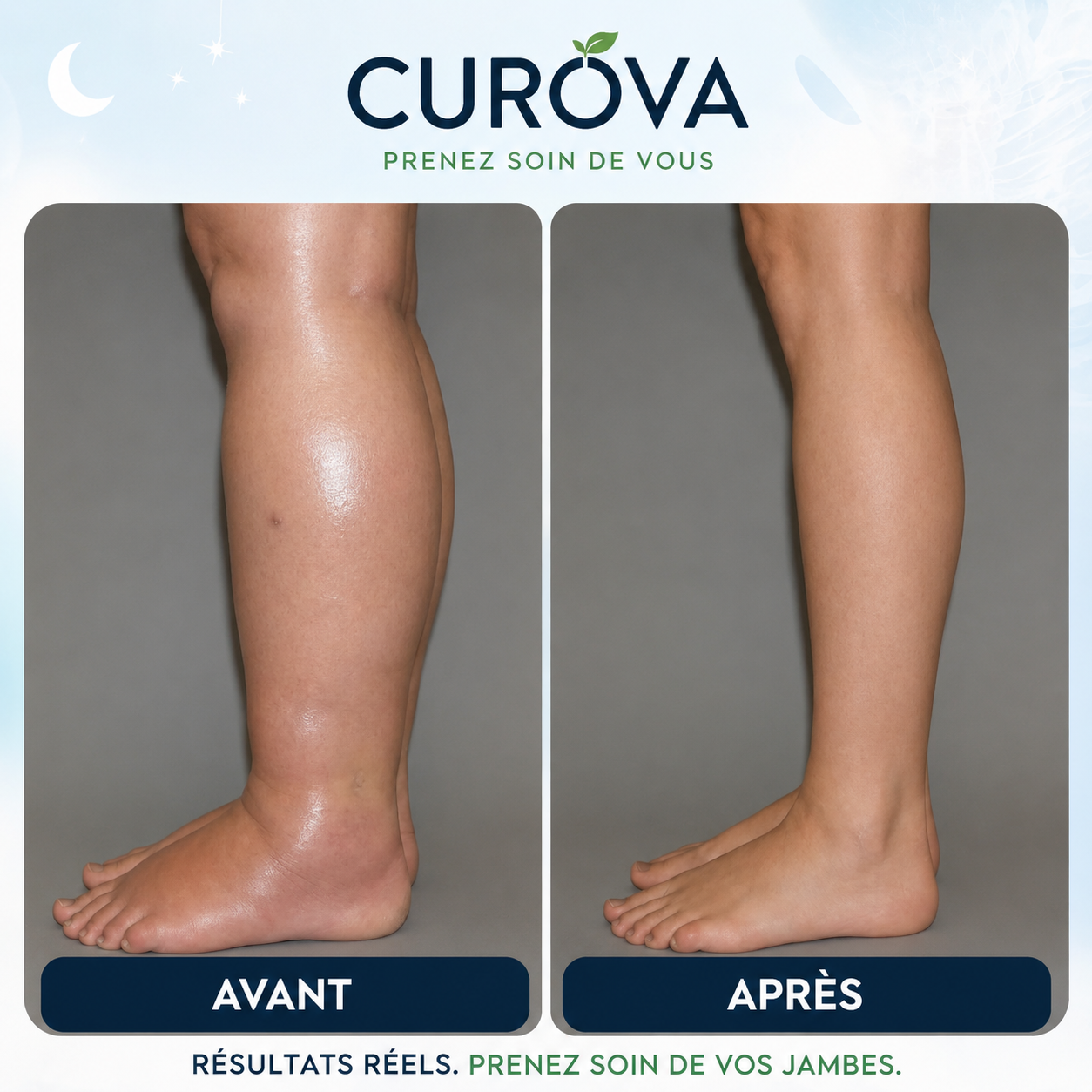 CUROVA - Soulagez vos jambes gonflées chez vous