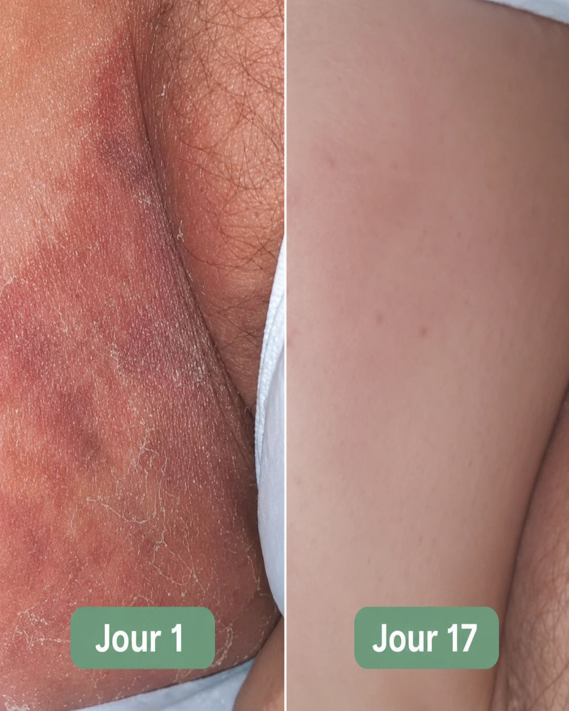 Savon antifongique CUROVA®
