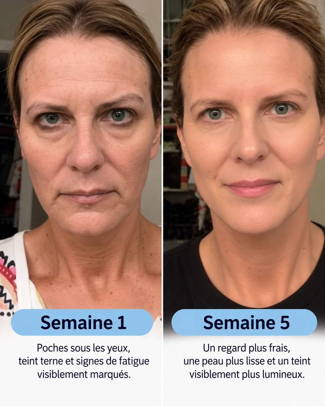 Curova™ Volufiline | Sérum au Collagène Coréen pour Peaux Matures