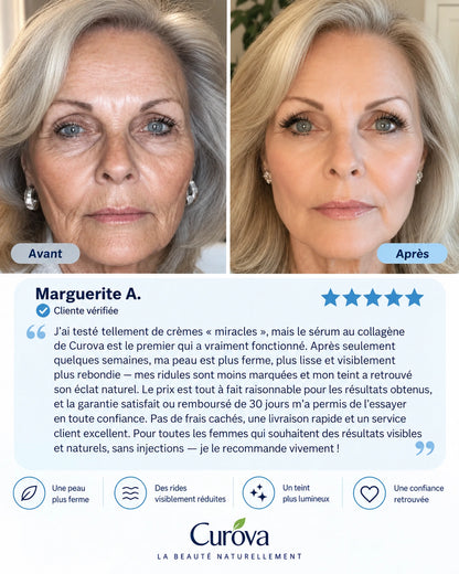 Curova™ Volufiline | Sérum au Collagène Coréen pour Peaux Matures