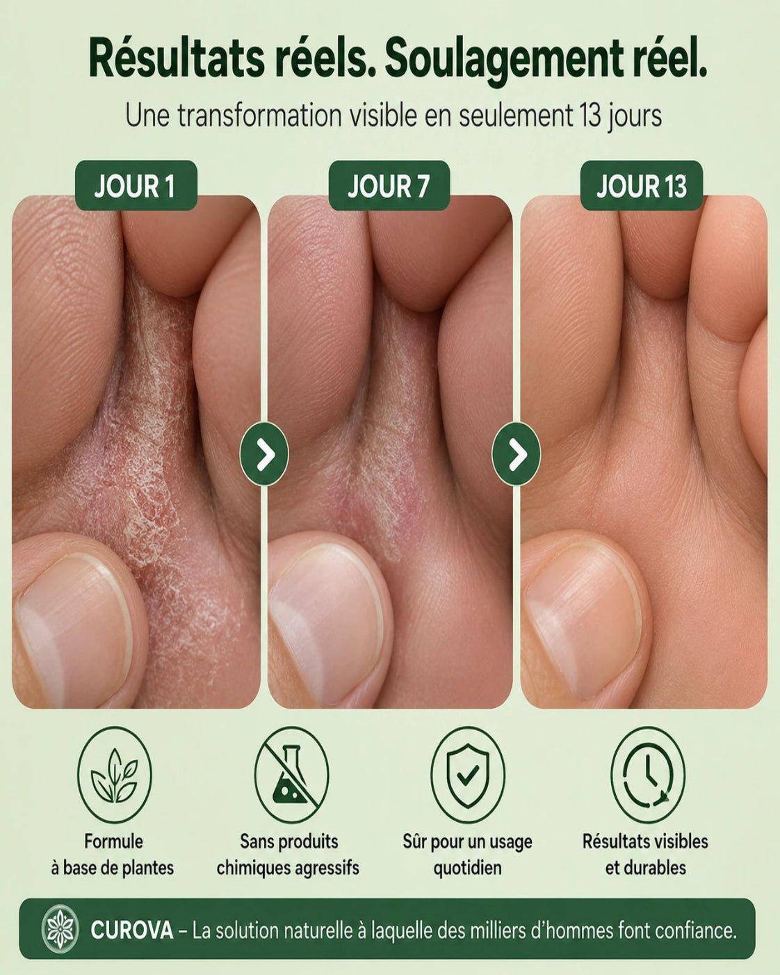 Savon antifongique CUROVA®