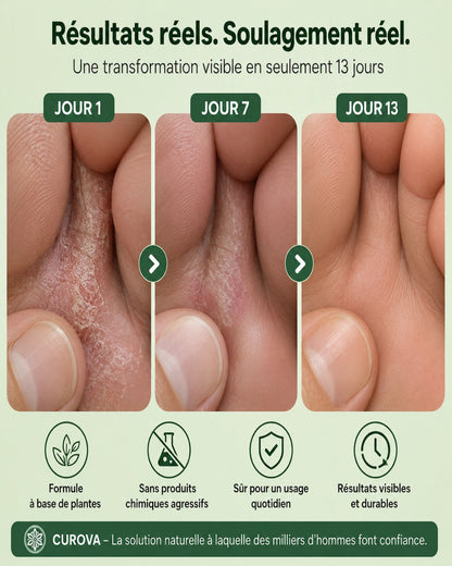 Savon antifongique CUROVA®