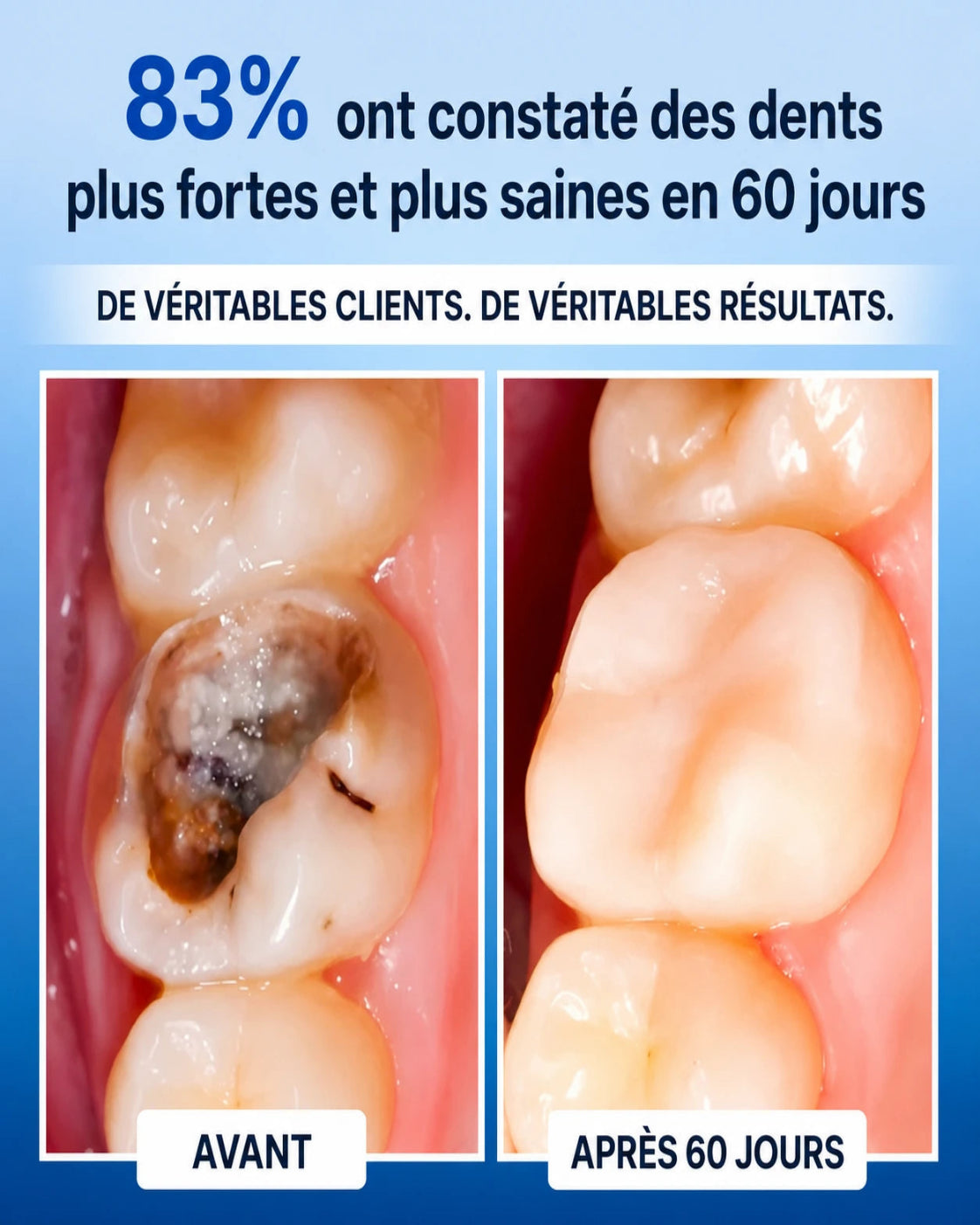 Curova Bouclier Dentaire