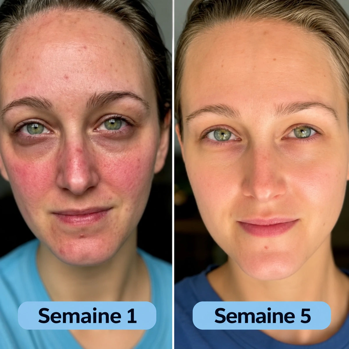 Curova™ Volufiline | Sérum au Collagène Coréen pour Peaux Matures