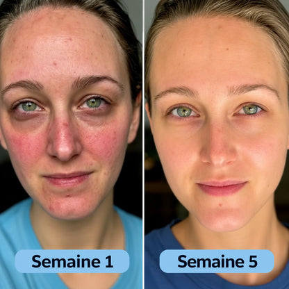 Curova™ Volufiline | Sérum au Collagène Coréen pour Peaux Matures