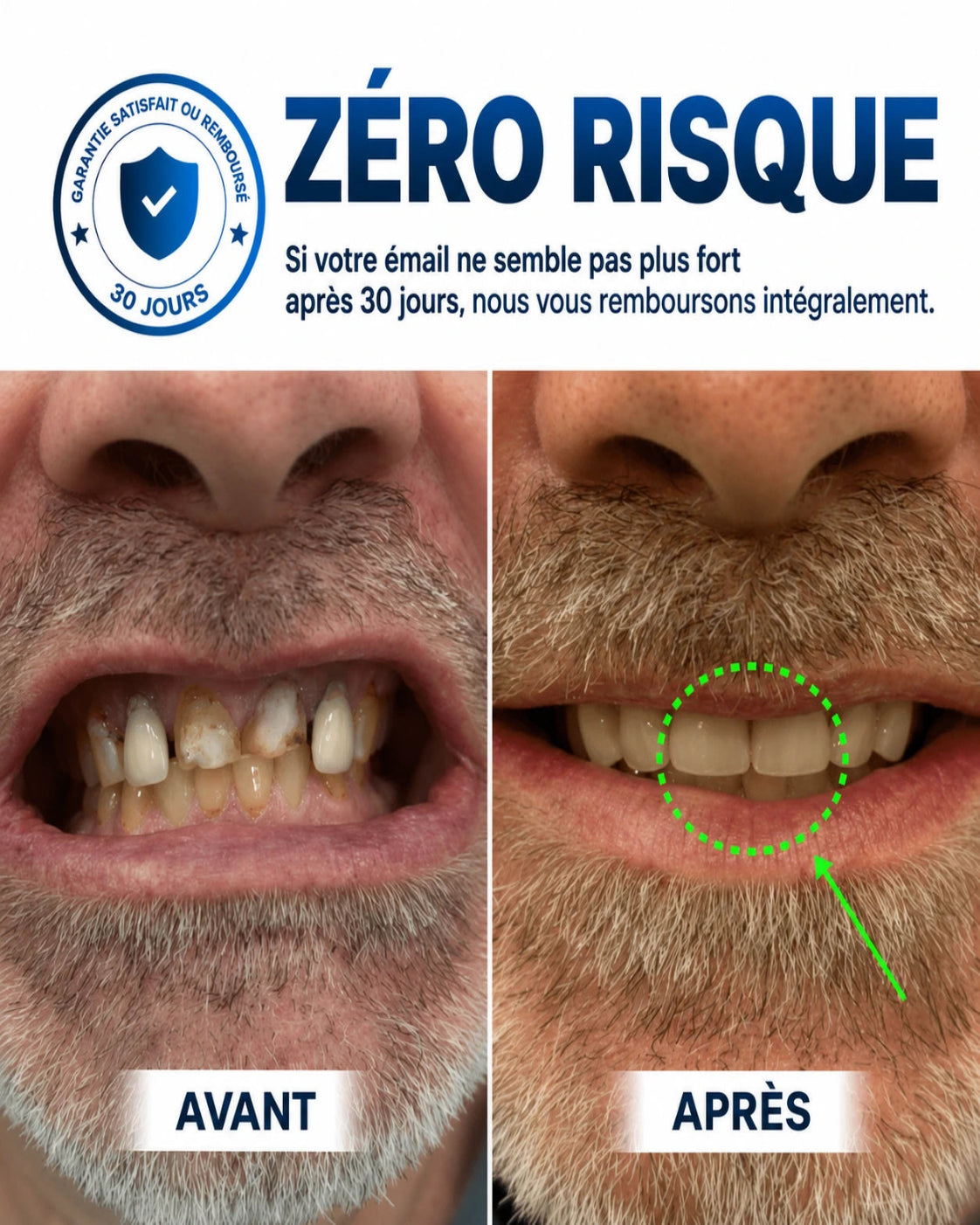 Curova Bouclier Dentaire